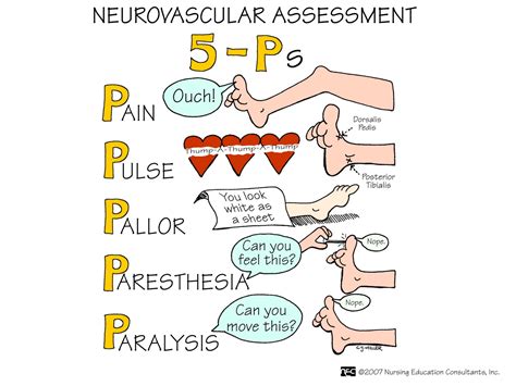 sickfaces.com mnemonic|Resources – NursingNotes.